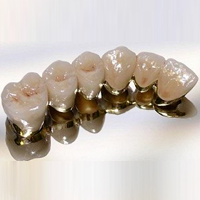 metallokeramika v stomatologii