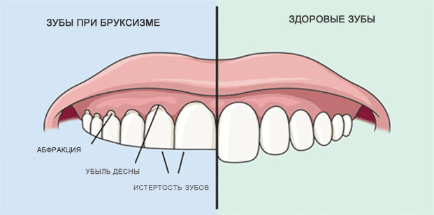 Бурксизм