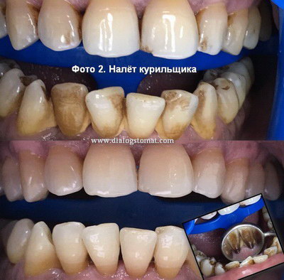 color stom 2